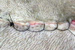 Interlocking suture